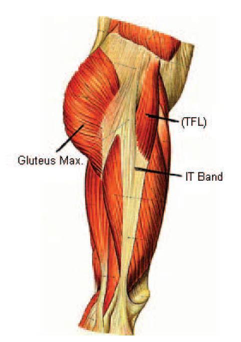 figure1