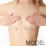 breast-lift-sm-70