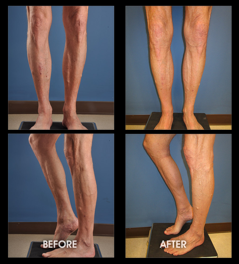 Why Can't I Make My Penis Bigger?