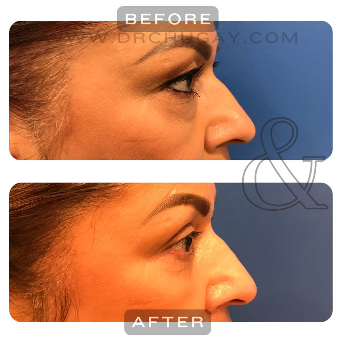 2025-fall-specials-eye-surgery
